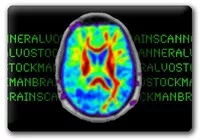 Brain Scanner by Alvo Stockman