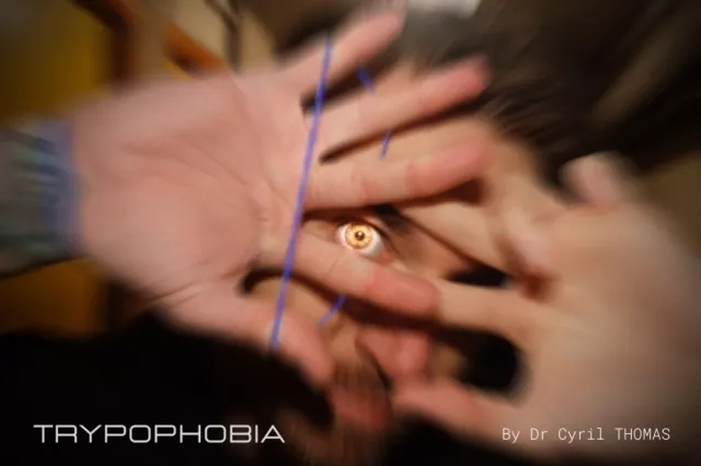 Trypophobia by Dr. Cyril Thomas